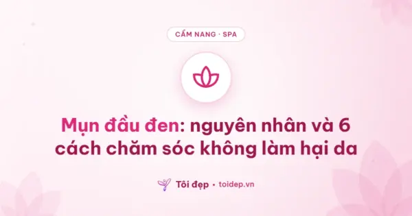 Mụn đầu đen: nguyên nhân và 6 cách chăm sóc không làm hại da